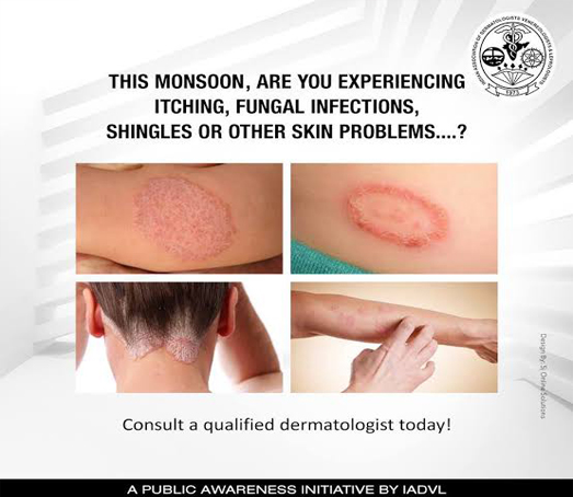 Skin Infections Treatment
