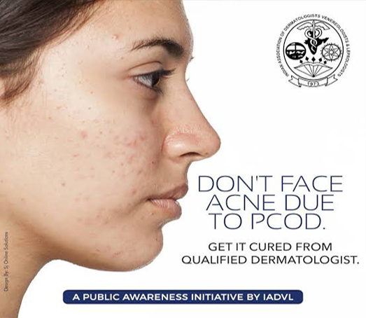 Face Acne Treatmentss